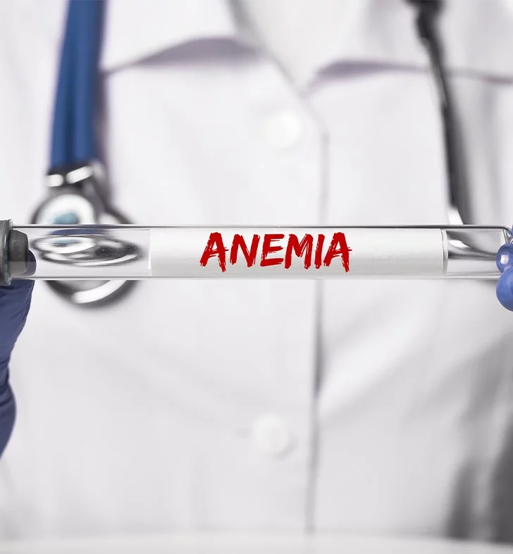 Anemia