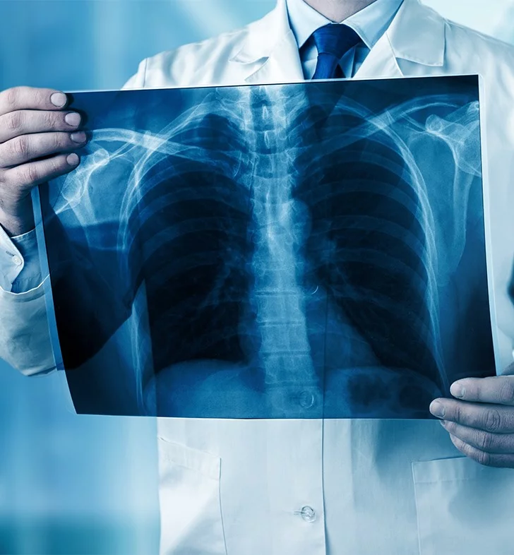 Aorta: Thoracic Aortic Aneurysm