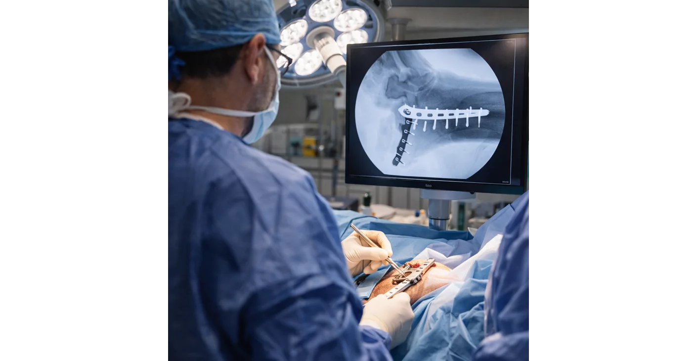 Complex Fracture Surgery