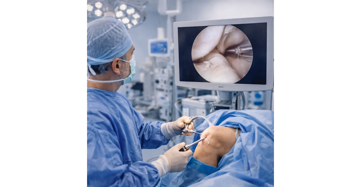 Knee Arthroscopy