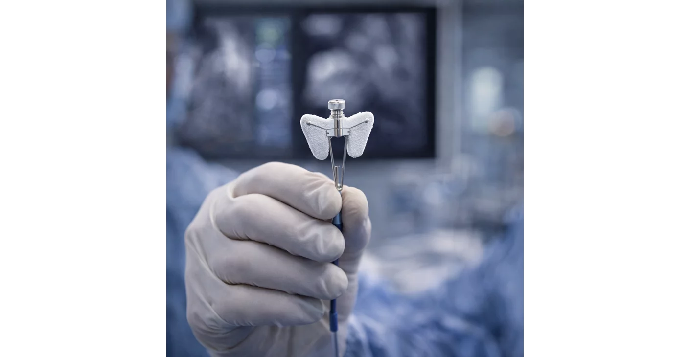 MitraClip Procedure (Transcatheter Mitral Valve Repair)